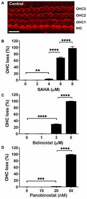 Histone Deacetylase Inhibitors Are Protective in Acute but Not in Chronic Models of Ototoxicity